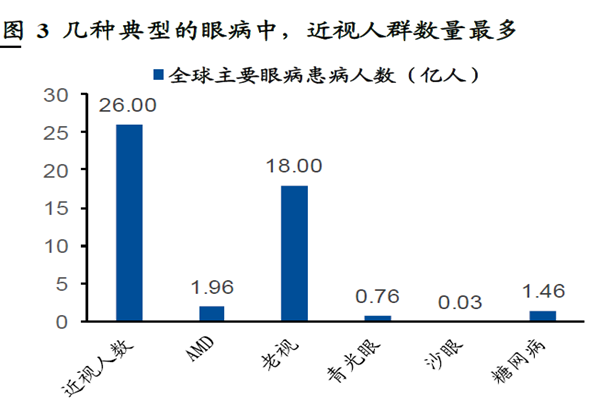幾種典型的眼病中,近視人群數量最多